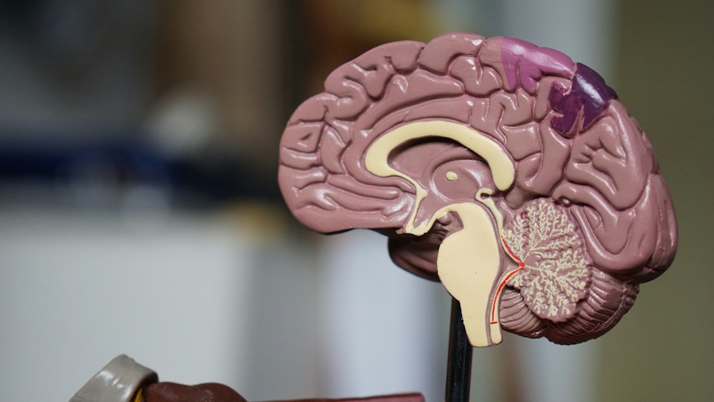 An anatomical brain model for neurological education